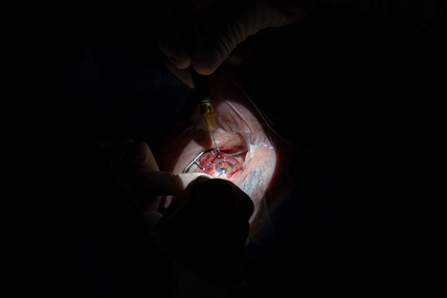 Eye surgery is performed against a black backdrop. 
